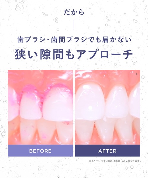 BEAURAL（ビューラル）の「BEAURAL ビューラル ウルトラファインバブルウォッシャー ノズル セット 口腔洗浄器（オーラルケア/歯磨きグッズ・レディース・バイオレット/ホワイト・ONE SIZE）」の5枚目の写真