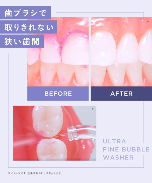 BEAURAL（ビューラル）の「BEAURAL ビューラル ウルトラファインバブルウォッシャー ノズル セット 口腔洗浄器（オーラルケア/歯磨きグッズ・レディース・バイオレット/ホワイト・ONE SIZE）」の17枚目の写真