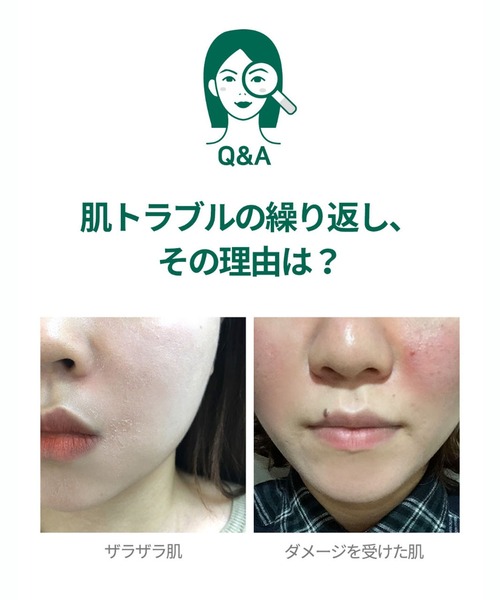 SOME BY MI（サムバイミー）の「【SOME BY MI / サムバイミー】ミラクルライン フェイスクリーム（ AHA-BHA-PHA 30 DAYS MIRACLE CREAM）（美容液/オイル/クリーム・レディース・SOME BY MI・FREE）」の4枚目の写真