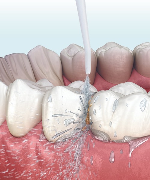 CALIFORNIA OUTFITTERS（カリフォルニア アウトフィッターズ）の「3-10E42 コードレス 口腔洗浄器 トゥースウォッシャー 口腔ケア（オーラルケア/歯磨きグッズ・レディース・ホワイト・ONESIZE）」の5枚目の写真