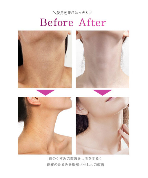 Laffia（ラフィア）の「首&目元用美顔器（美容器具・レディース・ホワイト・フリー）」の10枚目の写真