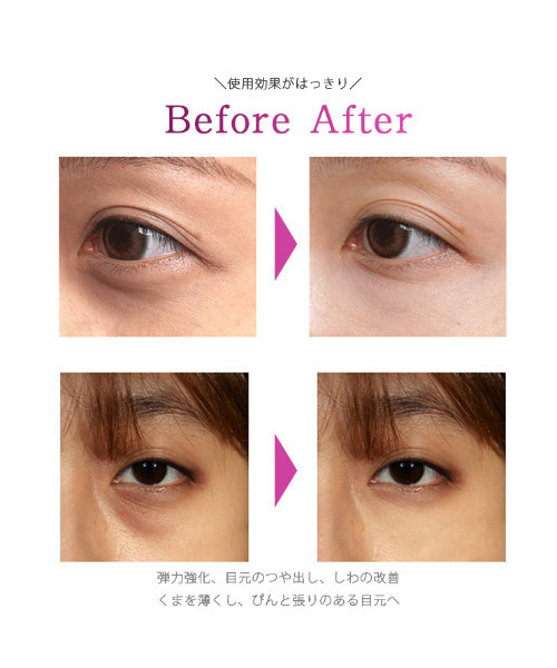 Laffia（ラフィア）の「首&目元用美顔器（美容器具・レディース・ホワイト・フリー）」の7枚目の写真